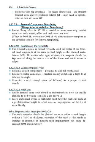 ± Problems with hip dysplasia ± (1) excess anteversion ± use straight
femoral stem and (2) posterior rotated GT ± may need to osteoto-
mise or even de-rotate GT
6.12.7.9 Femoral Component Templating
[Always After Acetabulum Templating]
n Ensure X-ray taken in 158 IR ± needed to most accurately predict
stem size, neck length, offset and neck resection level
(If hip in fixed ER, determine COM of hip then transpose template to
the opposite side hip for femoral templating)
6.12.7.10 Positioning the Template
n The femoral template is moved vertically until the centre of the femo-
ral head template is at the same vertical height as the planned aceta-
bulum COM. No matter what type of stem, the template should be
kept centred along the neutral axis of the femur and not in varus or
valgus
6.12.7.10.1 Various Implant Types
n Proximal-coated components ± proximal fit and fill emphasised
n Extensive-coated cementless ± fixation mainly distal, and a tight fit at
isthmus is sought
n Cemented ± need enough space (of 1±2 mm) for a proper cement
mantle
6.12.7.10.2 Neck Cut
n Ideally, femoral bone stock should be maintained and neck cut usually
planned to be between 1 cm and 2 cm above LT
n Pearl: anatomical stems in particular must have the neck cut made at
a predetermined height to avoid anterior impingement of the tip of
stem distally
What Happens with Improper Neck Cut
n The neck resection should be planned so as to utilise a neck length
without a `skirt' or thickened extension of the head, as this tends to
impinge at extremes of motion; such impingement can cause de-
creased ROM and instability
494 6 Total Joint Surgery
 