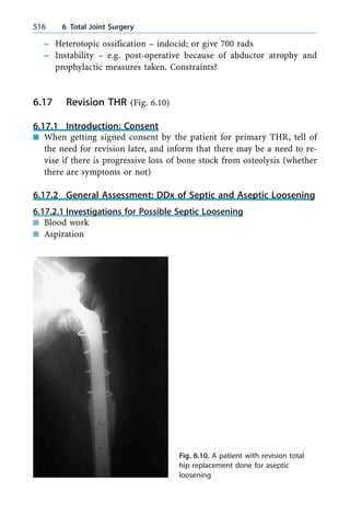 ± Heterotopic ossification ± indocid; or give 700 rads
± Instability ± e.g. post-operative because of abductor atrophy and
prophylactic measures taken. Constraints?
6.17 Revision THR (Fig. 6.10)
6.17.1 Introduction: Consent
n When getting signed consent by the patient for primary THR, tell of
the need for revision later, and inform that there may be a need to re-
vise if there is progressive loss of bone stock from osteolysis (whether
there are symptoms or not)
6.17.2 General Assessment: DDx of Septic and Aseptic Loosening
6.17.2.1 Investigations for Possible Septic Loosening
n Blood work
n Aspiration
516 6 Total Joint Surgery
Fig. 6.10. A patient with revision total
hip replacement done for aseptic
loosening
 