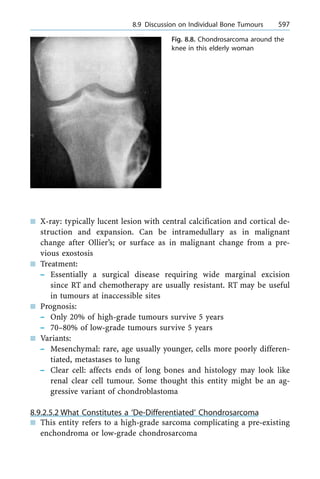 n X-ray: typically lucent lesion with central calcification and cortical de-
struction and expansion. Can be intramedullary as in malignant
change after Ollier's; or surface as in malignant change from a pre-
vious exostosis
n Treatment:
± Essentially a surgical disease requiring wide marginal excision
since RT and chemotherapy are usually resistant. RT may be useful
in tumours at inaccessible sites
n Prognosis:
± Only 20% of high-grade tumours survive 5 years
± 70±80% of low-grade tumours survive 5 years
n Variants:
± Mesenchymal: rare, age usually younger, cells more poorly differen-
tiated, metastases to lung
± Clear cell: affects ends of long bones and histology may look like
renal clear cell tumour. Some thought this entity might be an ag-
gressive variant of chondroblastoma
8.9.2.5.2 What Constitutes a `De-Differentiated' Chondrosarcoma
n This entity refers to a high-grade sarcoma complicating a pre-existing
enchondroma or low-grade chondrosarcoma
a 8.9 Discussion on Individual Bone Tumours 597
Fig. 8.8. Chondrosarcoma around the
knee in this elderly woman
 