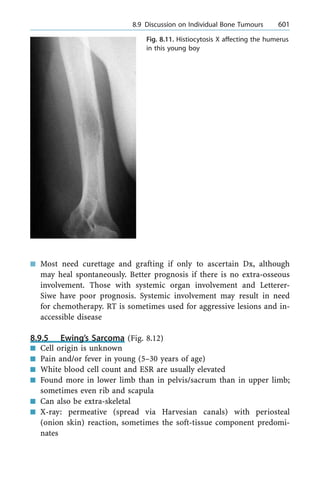 n Most need curettage and grafting if only to ascertain Dx, although
may heal spontaneously. Better prognosis if there is no extra-osseous
involvement. Those with systemic organ involvement and Letterer-
Siwe have poor prognosis. Systemic involvement may result in need
for chemotherapy. RT is sometimes used for aggressive lesions and in-
accessible disease
8.9.5 Ewing's Sarcoma (Fig. 8.12)
n Cell origin is unknown
n Pain and/or fever in young (5±30 years of age)
n White blood cell count and ESR are usually elevated
n Found more in lower limb than in pelvis/sacrum than in upper limb;
sometimes even rib and scapula
n Can also be extra-skeletal
n X-ray: permeative (spread via Harvesian canals) with periosteal
(onion skin) reaction, sometimes the soft-tissue component predomi-
nates
a 8.9 Discussion on Individual Bone Tumours 601
Fig. 8.11. Histiocytosis X affecting the humerus
in this young boy
 