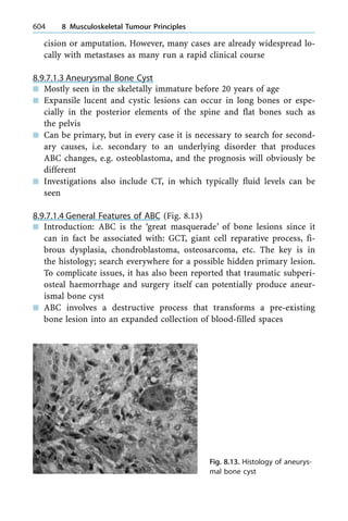 cision or amputation. However, many cases are already widespread lo-
cally with metastases as many run a rapid clinical course
8.9.7.1.3 Aneurysmal Bone Cyst
n Mostly seen in the skeletally immature before 20 years of age
n Expansile lucent and cystic lesions can occur in long bones or espe-
cially in the posterior elements of the spine and flat bones such as
the pelvis
n Can be primary, but in every case it is necessary to search for second-
ary causes, i.e. secondary to an underlying disorder that produces
ABC changes, e.g. osteoblastoma, and the prognosis will obviously be
different
n Investigations also include CT, in which typically fluid levels can be
seen
8.9.7.1.4 General Features of ABC (Fig. 8.13)
n Introduction: ABC is the `great masquerade' of bone lesions since it
can in fact be associated with: GCT, giant cell reparative process, fi-
brous dysplasia, chondroblastoma, osteosarcoma, etc. The key is in
the histology; search everywhere for a possible hidden primary lesion.
To complicate issues, it has also been reported that traumatic subperi-
osteal haemorrhage and surgery itself can potentially produce aneur-
ismal bone cyst
n ABC involves a destructive process that transforms a pre-existing
bone lesion into an expanded collection of blood-filled spaces
604 8 Musculoskeletal Tumour Principles
Fig. 8.13. Histology of aneurys-
mal bone cyst
 