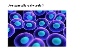 Are stem cells really useful?
 