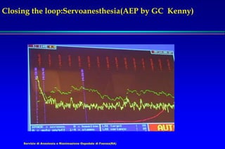 Servizio di Anestesia e Rianimazione Ospedale di Faenza(RA)
Closing the loop:Servoanesthesia(AEP by GC Kenny)
 