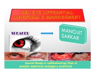 SPEAKER
Special Thanks to ophthalmology Dept. of
MALDA MEDICAL COLLEGE & HOSPITAL
 
