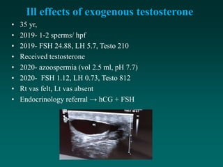 Ill effects of exogenous testosterone
• 35 yr,
• 2019- 1-2 sperms/ hpf
• 2019- FSH 24.88, LH 5.7, Testo 210
• Received testosterone
• 2020- azoospermia (vol 2.5 ml, pH 7.7)
• 2020- FSH 1.12, LH 0.73, Testo 812
• Rt vas felt, Lt vas absent
• Endocrinology referral → hCG + FSH
 