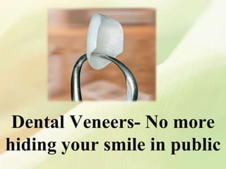 Dental Veneers- No more
hiding your smile in public
 