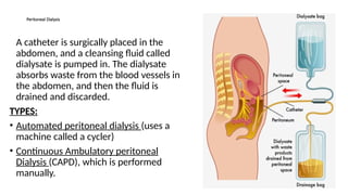 Acute renal failure Acute renal failure Acute renal failure | PPTX