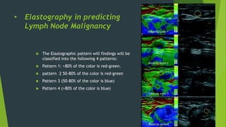 • Elastography in predicting
Lymph Node Malignancy
 The Elastographic pattern will findings will be
classified into the following 4 patterns:
 Pattern 1: >80% of the color is red-green.
 pattern 2 50-80% of the color is red-green
 Pattern 3 (50-80% of the color is blue)
 Pattern 4 (>80% of the color is blue)
 