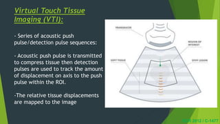Virtual Touch Tissue
Imaging (VTI):
- Series of acoustic push
pulse/detection pulse sequences:
- Acoustic push pulse is transmitted
to compress tissue then detection
pulses are used to track the amount
of displacement on axis to the push
pulse within the ROI.
-The relative tissue displacements
are mapped to the image
ECR 2012 / C-1477
 