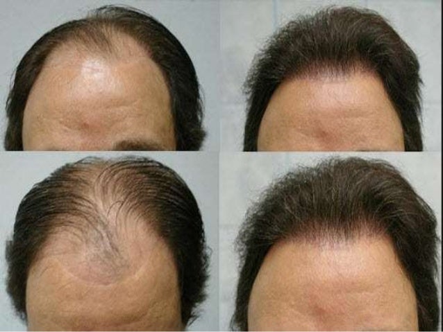 How To Make Hair Grow Faster With Arganlife