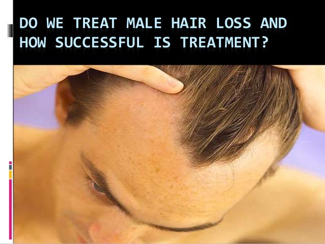 Know How To Stop Hair Loss And Regrow Hair