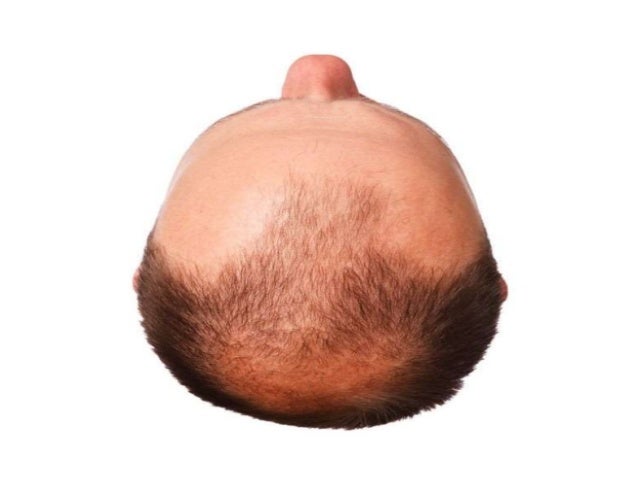 Arganlife Anti Hair Loss Shampoo
