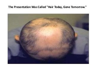 The Presentation Was Called "Hair Today, Gone Tomorrow."
 