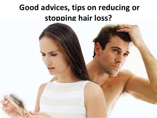 How To Hide Thinning Hair Men S Grooming
