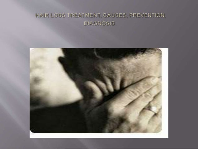 Male Pattern Baldness Home Remedies For Hair Growth