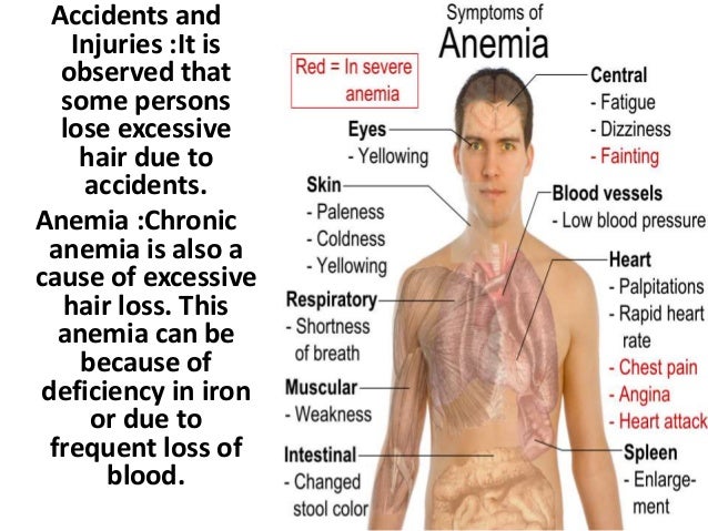 How To Cure Iron Deficiency Anemia Naturally How To Cure Iron Deficiency Anemia Naturally
