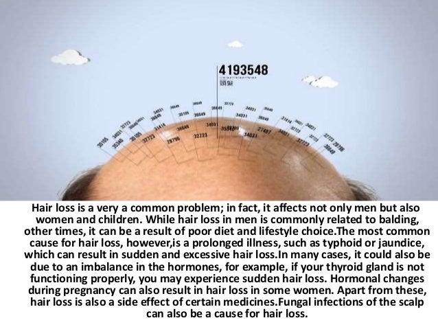 Best Hair Loss Treatment How To Stop Hair Loss Naturally And Baldne