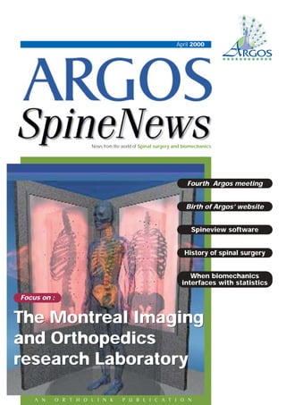 April 2000
News from the world of Spinal surgery and biomechanics
Focus on :
Birth of Argos’ website
Spineview software
History of spinal surgery
When biomechanics
interfaces with statistics
Fourth Argos meeting
The Montreal Imaging
and Orthopedics
research Laboratory
The Montreal Imaging
and Orthopedics
research Laboratory
A N O R T H O L I N K P U B L I C A T I O N
 