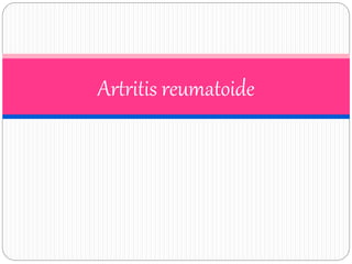 Artritis reumatoide
 