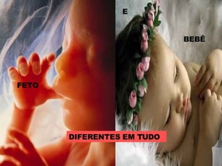 DIFERENTES EM TUDO FETO E BEBÊ 