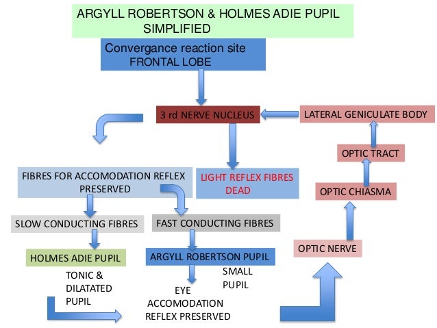 argyll robertson pupil video argyll robertson pupil video