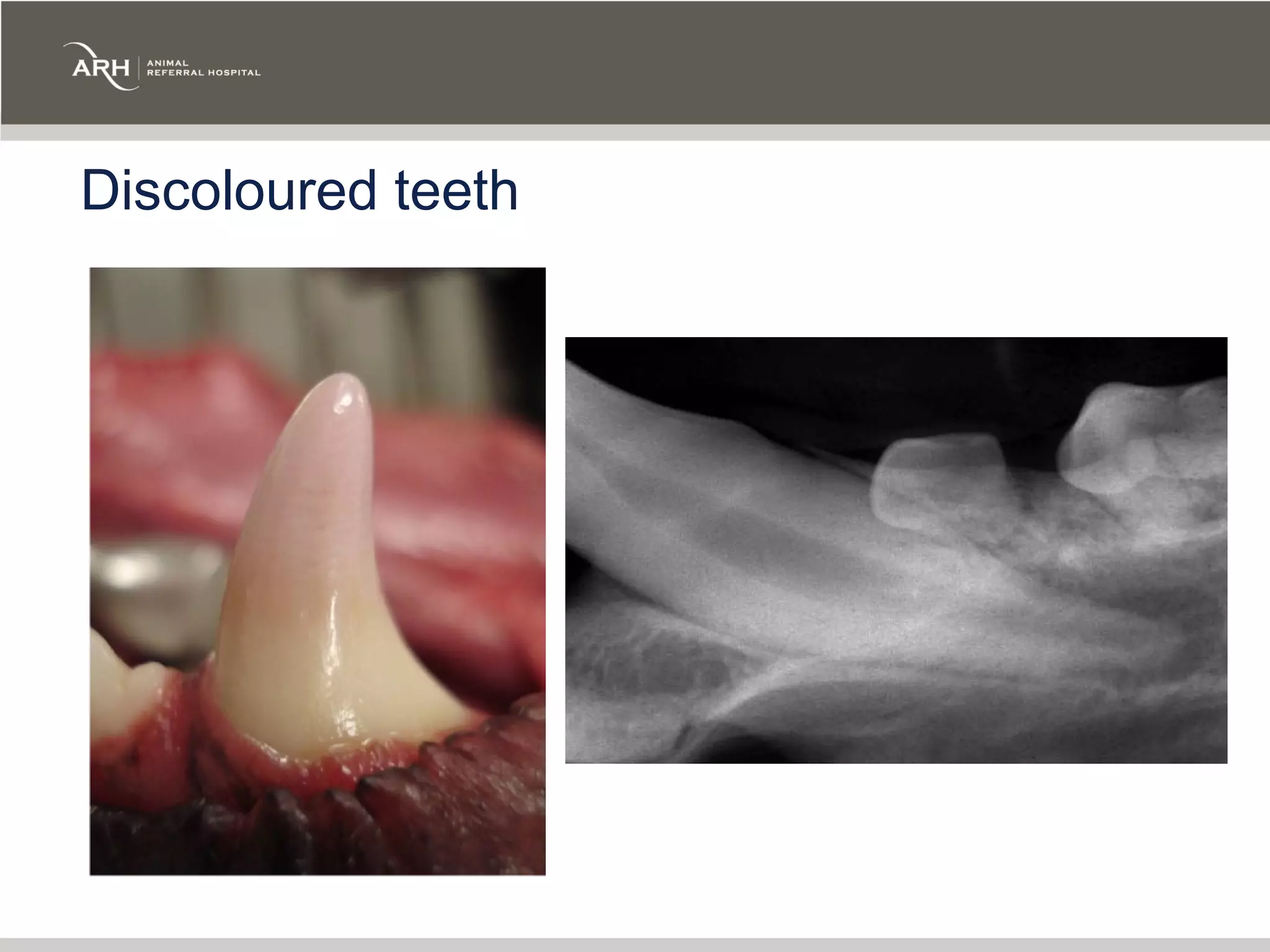 Discoloured teeth
 