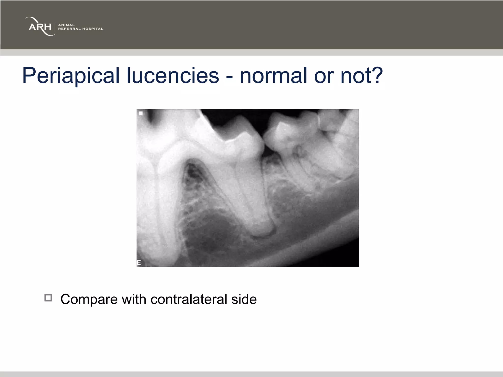 Periapical lucencies - normal or not?




     Compare with contralateral side
 