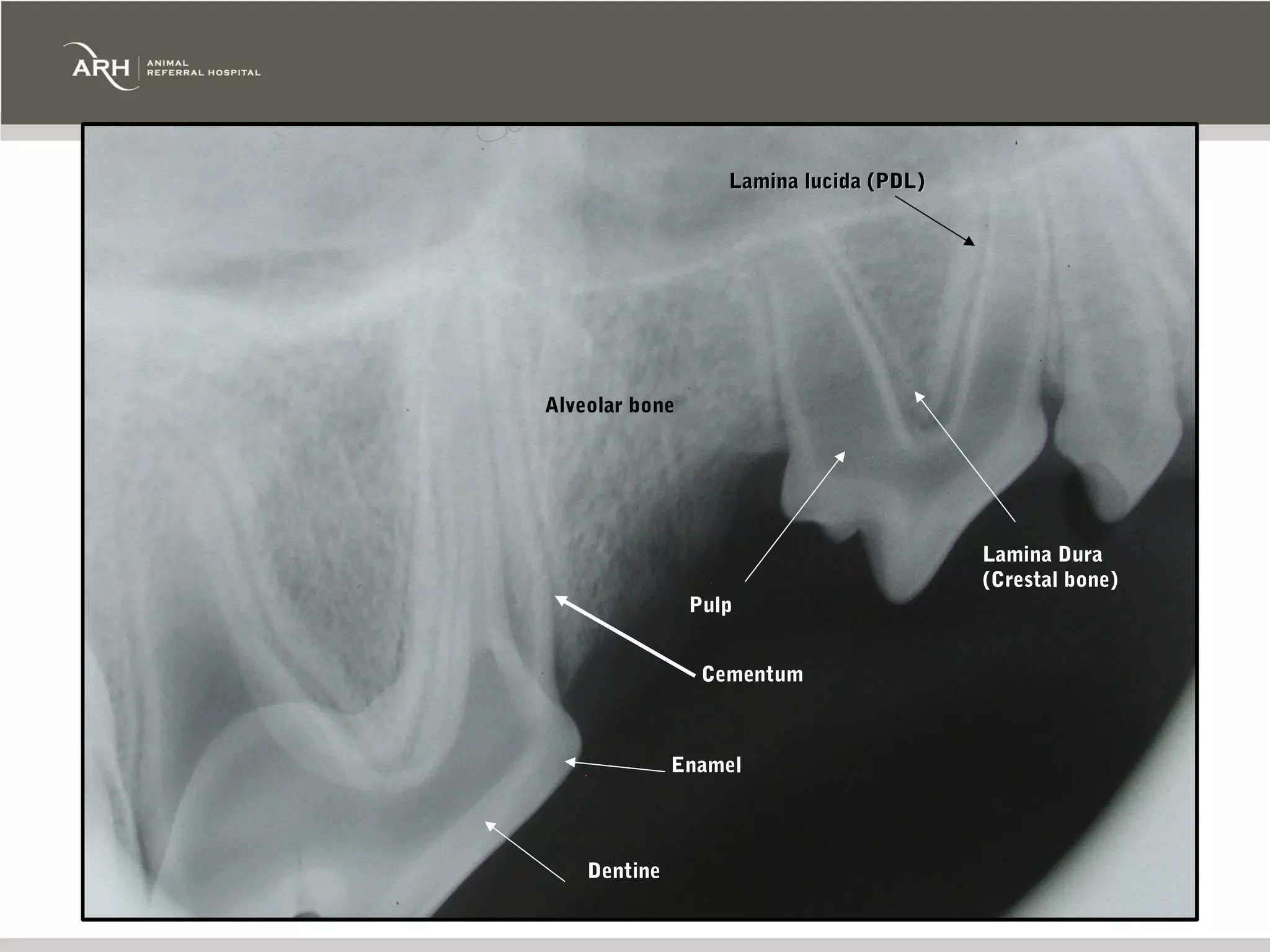 Lamina lucida (PDL)




Alveolar bone




                                         Lamina Dura
                                         (Crestal bone)
                Pulp


                 Cementum



              Enamel




    Dentine
 