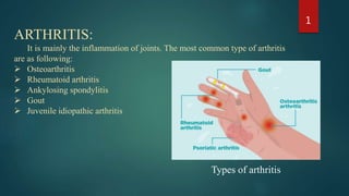 ARTHRITIS:
It is mainly the inflammation of joints. The most common type of arthritis
are as following:
 Osteoarthritis
 Rheumatoid arthritis
 Ankylosing spondylitis
 Gout
 Juvenile idiopathic arthritis
1
Types of arthritis
 