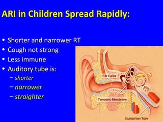 23
ARI in Children Spread Rapidly:ARI in Children Spread Rapidly:
• Shorter and narrower RTShorter and narrower RT
• Cough not strongCough not strong
• Less immuneLess immune
• Auditory tube is:Auditory tube is:
– shortershorter
– narrowernarrower
– straighterstraighter
 