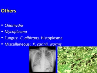 41
Others
• Chlamydia
• Mycoplasma
• Fungus: C. albicans, Histoplasma
• Miscellaneous: P. carinii, worms
 