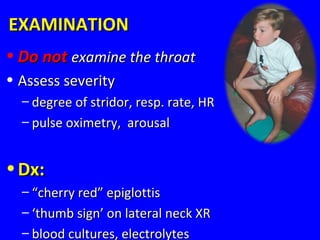 EXAMINATIONEXAMINATION
• Do notDo not examine the throatexamine the throat
• Assess severityAssess severity
– degree of stridor, resp. rate, HRdegree of stridor, resp. rate, HR
– pulse oximetry, arousalpulse oximetry, arousal
• Dx:Dx:
– ““cherry red” epiglottischerry red” epiglottis
– ‘‘thumb sign’ on lateral neck XRthumb sign’ on lateral neck XR
– blood cultures, electrolytesblood cultures, electrolytes
 