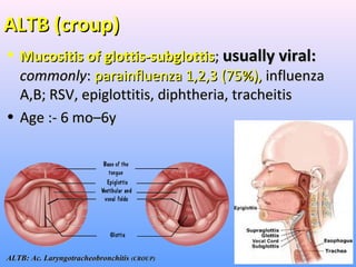 ALTB (croup)ALTB (croup)
• Mucositis of glottis-subglottisMucositis of glottis-subglottis;; usually viral:usually viral:
commonlycommonly:: parainfluenza 1,2,3 (75%),parainfluenza 1,2,3 (75%), influenzainfluenza
A,B; RSV,A,B; RSV, epiglottitis, diphtheria, tracheitisepiglottitis, diphtheria, tracheitis
• Age :- 6 mo–6yAge :- 6 mo–6y
ALTB: Ac. LaryngotracheobronchitisALTB: Ac. Laryngotracheobronchitis (CROUP)(CROUP)
 
