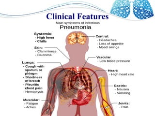 Acute respiratory infection (ARI) | ODP