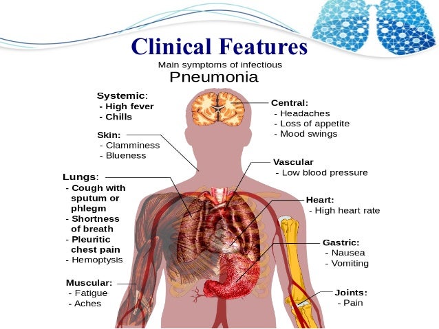 Upper Respiratory Infection Joint Pain - Human Anatomy