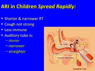 24
ARI in ChildrenARI in Children Spread Rapidly:Spread Rapidly:
• Shorter & narrower RTShorter & narrower RT
• Cough not strongCough not strong
• Less immuneLess immune
• Auditory tube is:Auditory tube is:
– shortershorter
– narrowernarrower
– straighterstraighter
 