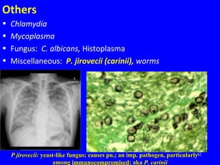 42
Others
• Chlamydia
• Mycoplasma
• Fungus: C. albicans, Histoplasma
• Miscellaneous: P. jirovecii (carinii), worms
P jirovecii:P jirovecii: yeast-like fungus; causes pn.; an imp. pathogen, particularlyyeast-like fungus; causes pn.; an imp. pathogen, particularly
amongamong immunocompromisedimmunocompromised; aka; aka P. cariniiP. carinii
 