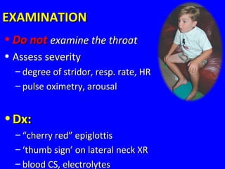 EXAMINATIONEXAMINATION
• Do notDo not examine the throatexamine the throat
• Assess severityAssess severity
– degree of stridor, resp. rate, HRdegree of stridor, resp. rate, HR
– pulse oximetry, arousalpulse oximetry, arousal
• Dx:Dx:
– ““cherry red” epiglottischerry red” epiglottis
– ‘‘thumb sign’ on lateral neck XRthumb sign’ on lateral neck XR
– blood CS, electrolytesblood CS, electrolytes
 