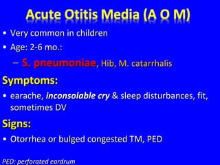 • Very common in childrenVery common in children
• Age: 2-6 mo.:Age: 2-6 mo.:
– S. pneumoniaeS. pneumoniae, Hib, M. catarrhalis, Hib, M. catarrhalis
Symptoms:Symptoms:
• earache,earache, inconsolable cryinconsolable cry & sleep disturbances, fit,& sleep disturbances, fit,
sometimes DVsometimes DV
Signs:Signs:
• Otorrhea or bulged congested TM, PEDOtorrhea or bulged congested TM, PED
PED: perforated eardrumPED: perforated eardrum
 