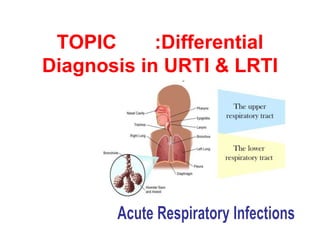 TOPIC :Differential
Diagnosis in URTI & LRTI
 