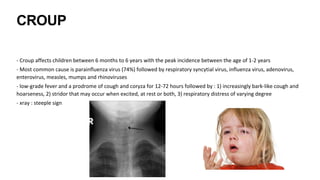 CROUP
- Croup affects children between 6 months to 6 years with the peak incidence between the age of 1-2 years
- Most common cause is parainfluenza virus (74%) followed by respiratory syncytial virus, influenza virus, adenovirus,
enterovirus, measles, mumps and rhinoviruses
- low-grade fever and a prodrome of cough and coryza for 12-72 hours followed by : 1) increasingly bark-like cough and
hoarseness, 2) stridor that may occur when excited, at rest or both, 3) respiratory distress of varying degree
- xray : steeple sign
 