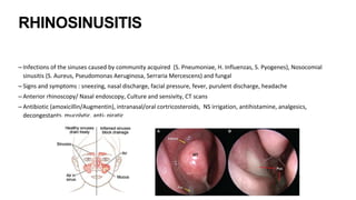RHINOSINUSITIS
– Infections of the sinuses caused by community acquired (S. Pneumoniae, H. Influenzas, S. Pyogenes), Nosocomial
sinusitis (S. Aureus, Pseudomonas Aeruginosa, Serraria Mercescens) and fungal
– Signs and symptoms : sneezing, nasal discharge, facial pressure, fever, purulent discharge, headache
– Anterior rhinoscopy/ Nasal endoscopy, Culture and sensivity, CT scans
– Antibiotic (amoxicillin/Augmentin), intranasal/oral cortricosteroids, NS irrigation, antihistamine, analgesics,
decongestants, mucolytic, anti- piratic
 