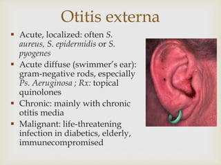 acute respiratory infection ppt-140416232653-phpapp01.pptx