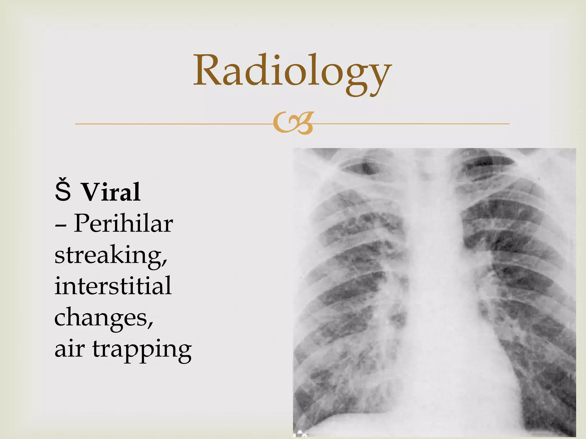 
Radiology
Š Viral
– Perihilar
streaking,
interstitial
changes,
air trapping
 