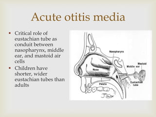 Acute otitis media
 Critical role of
eustachian tube as
conduit between
nasopharynx, middle
ear, and mastoid air
cells
 Children have
shorter, wider
eustachian tubes than
adults
 