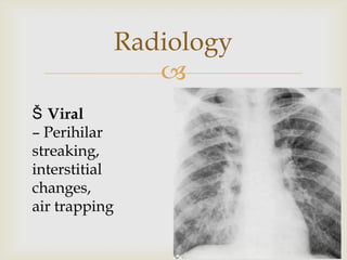 
Radiology
Š Viral
– Perihilar
streaking,
interstitial
changes,
air trapping
 