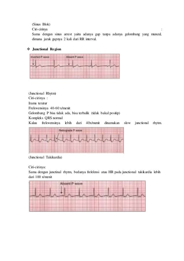10 Cirikarakteristik Terkena Sinusitis Yang Mudah Dikenali Halosehat