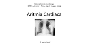 Aritmia Cardiaca
Innovations in cardiology
XXIII edizione – Roma 24-26 Maggio 2023
Dr Mario Rossi
 