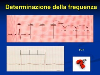 Determinazione della frequenza
FC ?
 