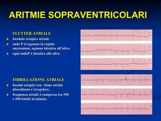 ARITMIE SOPRAVENTRICOLARI
FLUTTER ATRIALE
 focolaio ectopico atriale.
 onde P si seguono in rapida
successione, ognuna identica all’altra.
 ogni ondaP è identica alle altre.
FIBRILLAZIONE ATRIALE
 focolai ectopici con ritmo atriale
disordinato e irregolare,
 frequenza atriale è compresa tra 350
e 450 battiti al minuto.
 